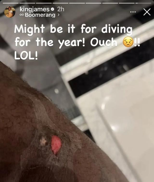 詹姆斯鱼跃救球致膝盖受伤引热议